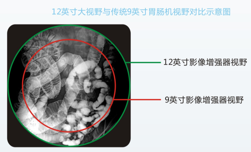 數字化胃腸機