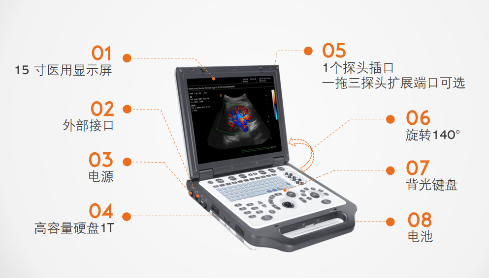 便攜式彩超設備